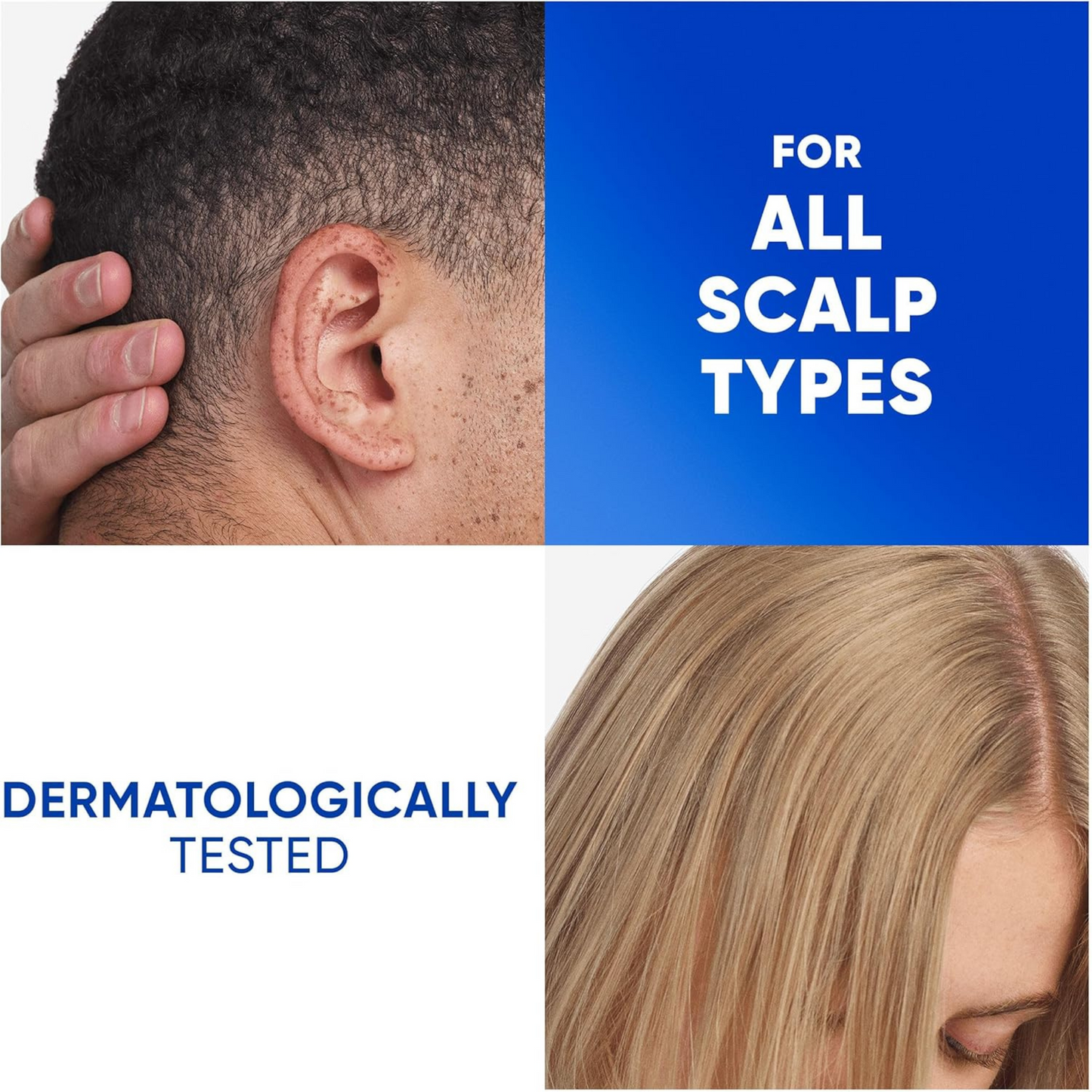 Head & Shoulders Anti-Dandruff Shampoo Apple Fresh Microbiome Balance care cleans genuine UK imported hair-fall Best authentic Shine dry smooth low price in BD